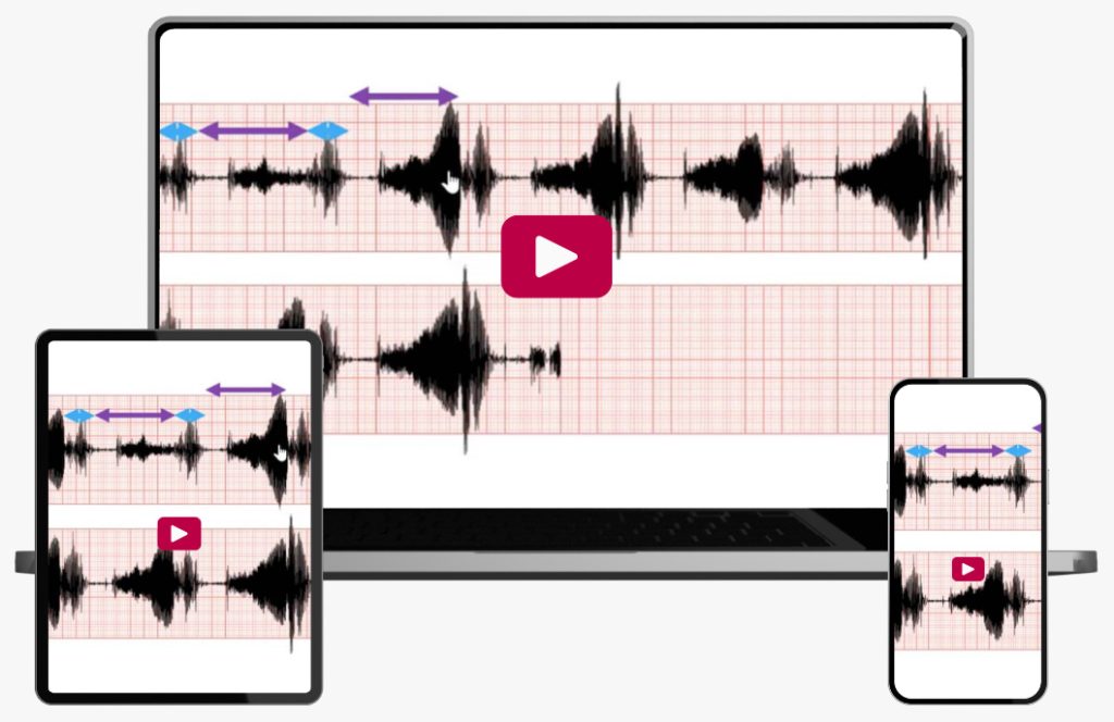 Clinical Approach to a horse with a heart murmur with Dr. Katharyn Mitchell
BVSc, DVCS, DVM-PhD, Dip ACVIM-LAIM