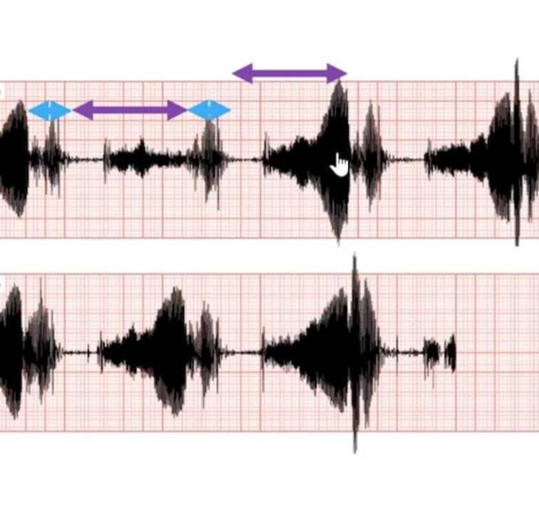 Clinical Approach to a horse with a heart murmur