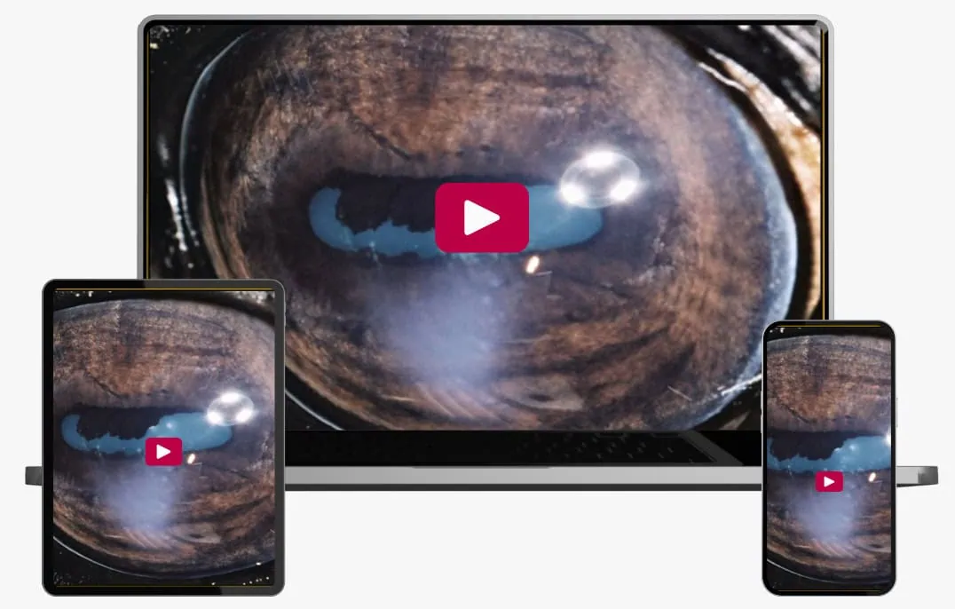 Clinical approach to Uveitis with Dr. Caryn Plummer